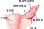 平滑肌肉瘤