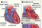 甲狀腺血管瘤