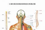 脊髓壓迫癥