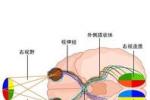 視交叉病變