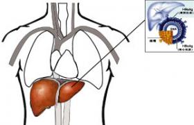 老年人肝硬化