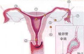 宮頸妊娠