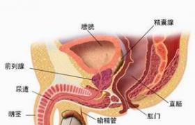 前列腺炎