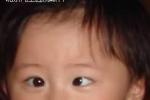 外隱斜