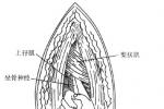 跗管綜合征