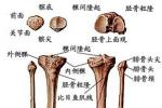 髕骨不穩定