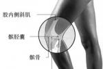 髕骨骨軟骨病