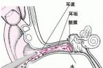 鼓膜炎