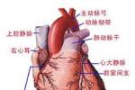 肺源性心臟病
