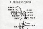 肝外膽管損傷