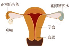 產後虛脫