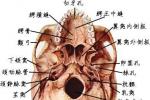 顱底骨折