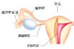 尿崩癥