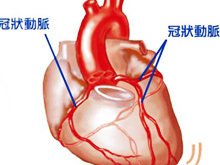 冠狀動脈異位起源