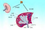 轉移性胸膜腫瘤