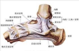 踝關節扭傷
