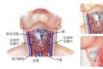 慢性淋巴細胞性甲狀腺炎