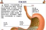 胃動脈硬化