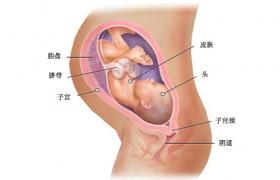 胎兒生長受限