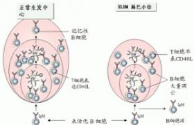 吞噬功能缺陷病