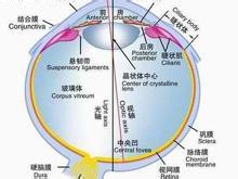 間歇性外斜視