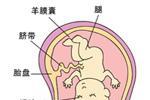 胎兒宮內發育遲緩