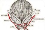 陰道惡性腫瘤