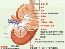 IgA腎病