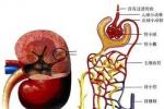 IgA腎病