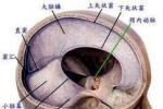 小兒顱內出血