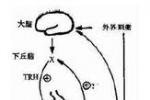 高泌乳素血癥