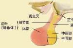 高泌乳素血癥