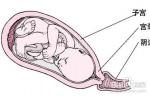 小兒腦膿腫