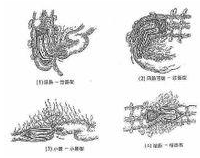 蛔蟲性腸梗阻