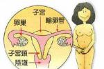 輸卵管積水