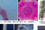 腦包蟲病