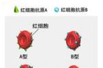 Rh血型不合溶血病