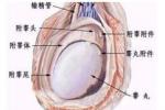 精索惡性腫瘤