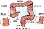 大腸癌