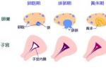 子宮內膜增生癥