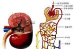 紫癜性腎炎