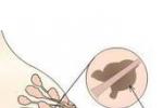 乳頭狀小汗腺腺瘤