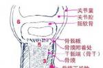 化膿性骨髓炎
