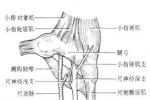 腕尺管綜合征