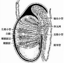 睪丸囊腫