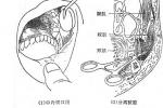 痙攣性斜頸