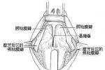 懸雍垂過長癥