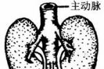 馬蹄形腎