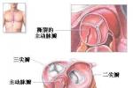 老年人退行性心臟瓣膜病