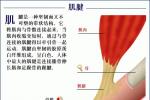 肌肉肌腱單位的急性損傷